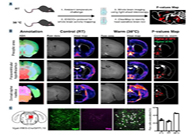 减肥药瞄准新靶点，强效减肥药即将来袭？