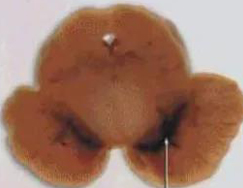 正常人：正：谥