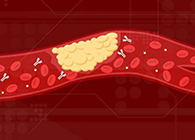 【Science速递】攻克COVID-19里程碑：已确定血凝块形成原因！
