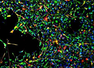 世界首创：药物将干细胞引导至受损部位，提高其愈合能力！