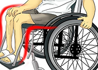 Nature：还瘫痪患者一个自由身的日子不远了