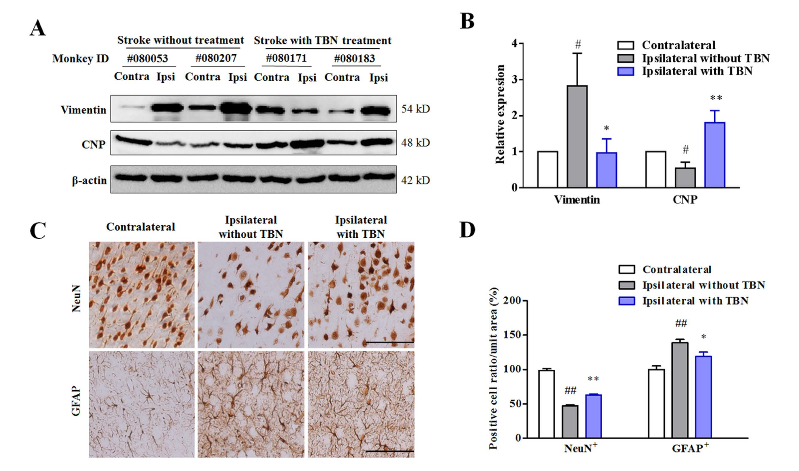 TBN是一种治疗缺血性卒中的新型临床候选药物，本研究中TBN通过不朽情缘mg官网合成